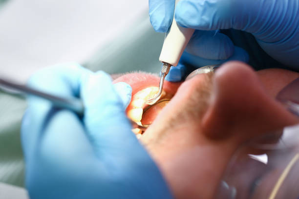 Best Emergency Dentist for Knocked-Out Tooth in Chester Gap, VA