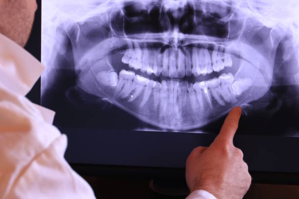 Best Emergency Dental Services for Seniors in Chester Gap, VA